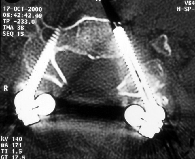 Fig. 4