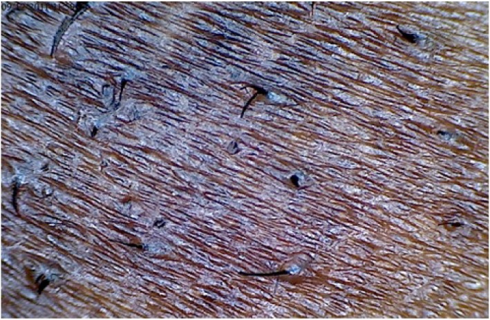 Figure 5