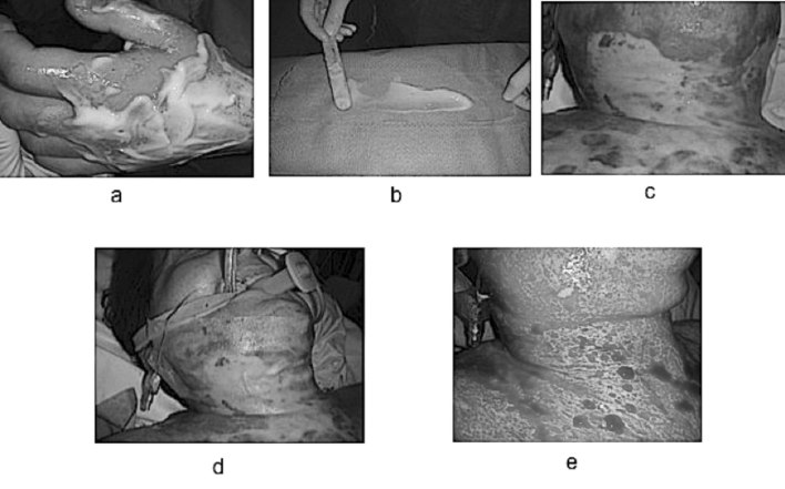 Fig. 4