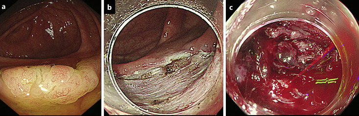 Fig. 2.