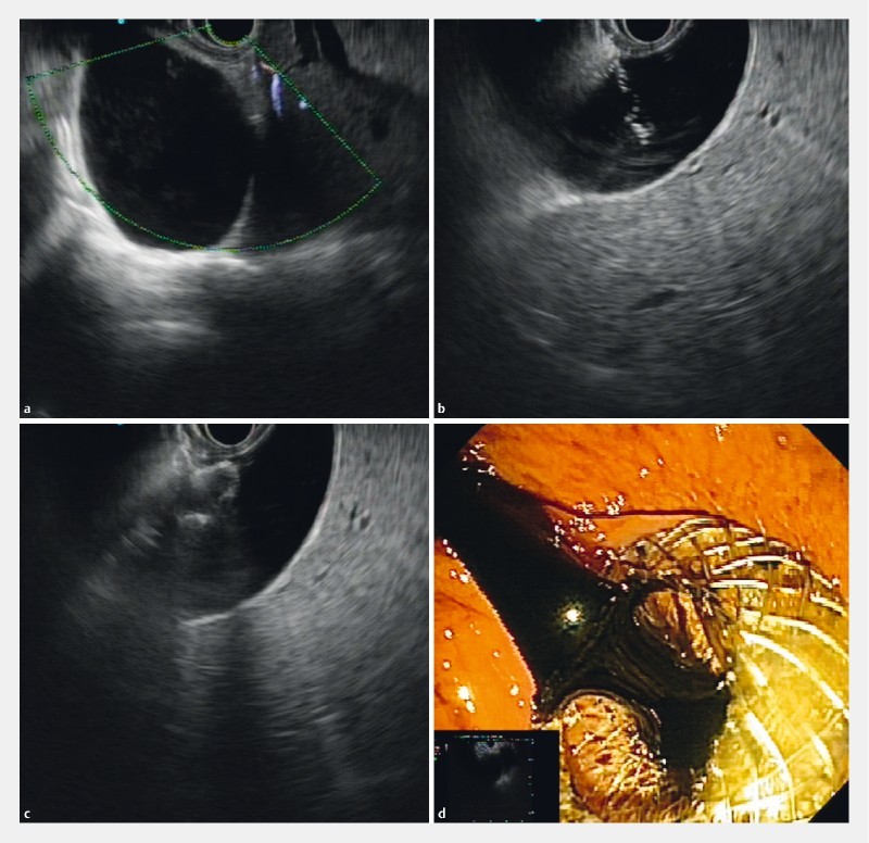 Fig. 2 