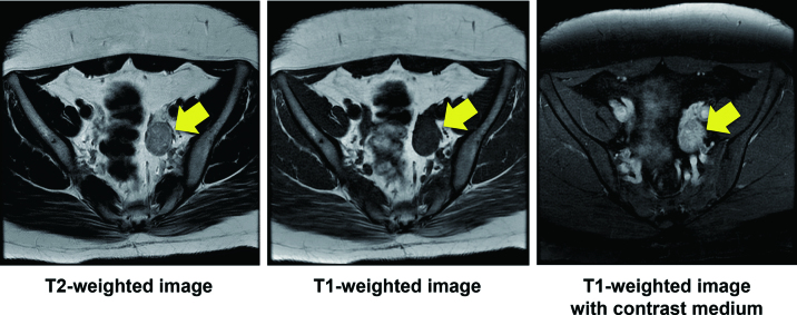 Fig. 3.