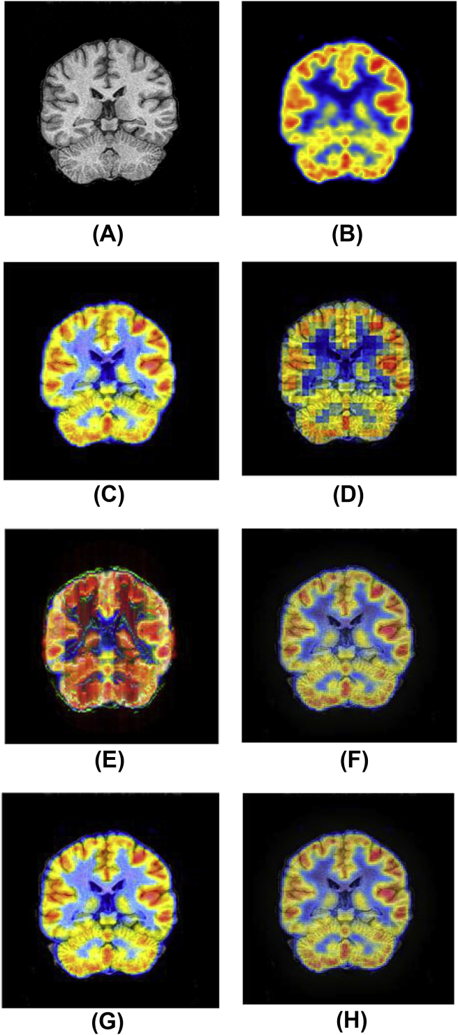 Fig. 4