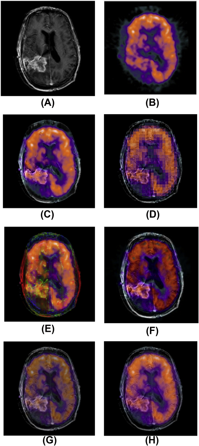 Fig. 3