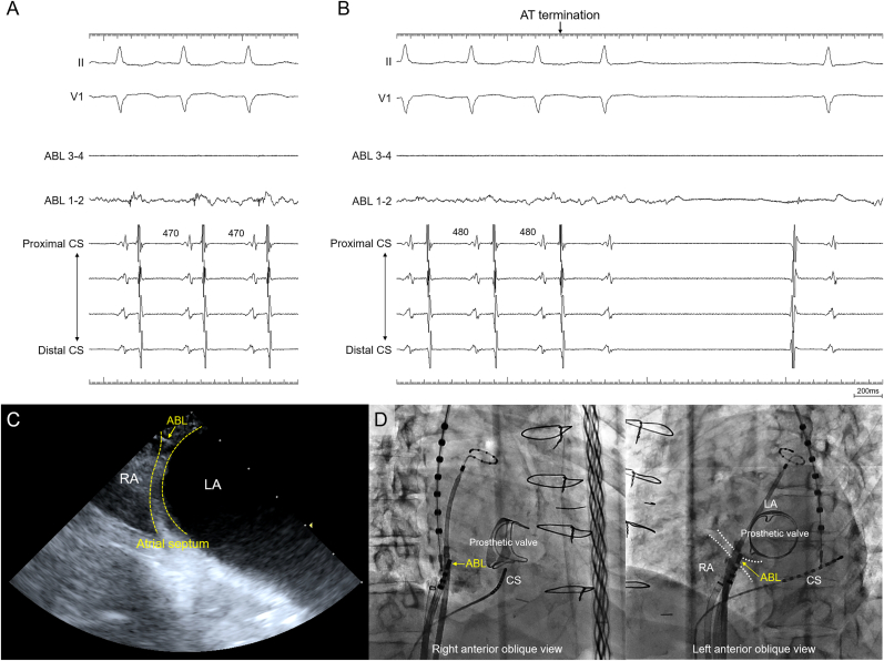 Fig. 3