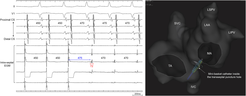 Fig. 2