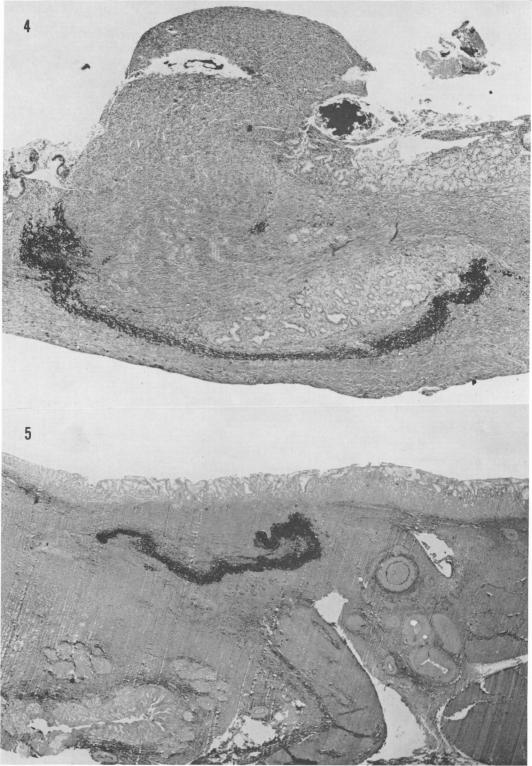 Fig. 4., Fig. 5.