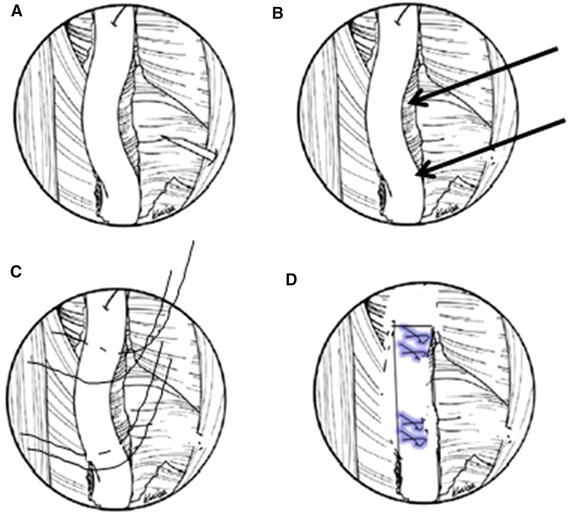 Fig. 10