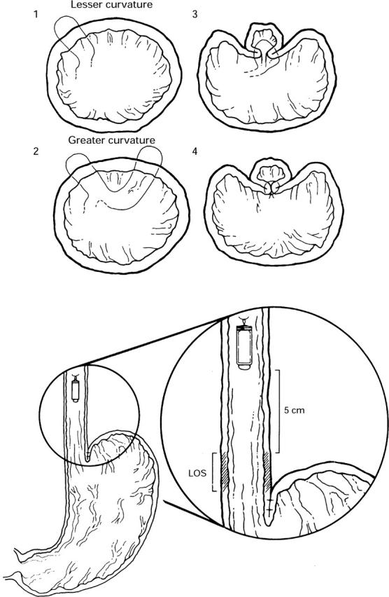 Figure 1  