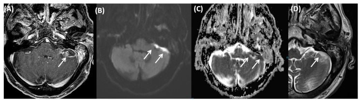 Figure 19