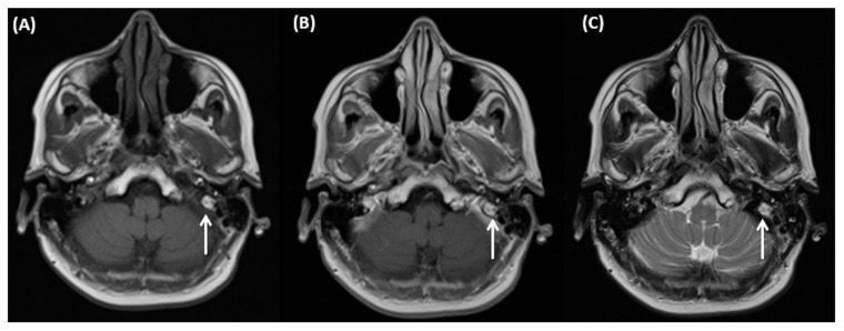 Figure 17