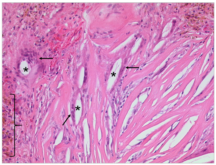 Figure 16