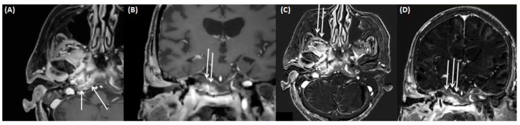 Figure 18