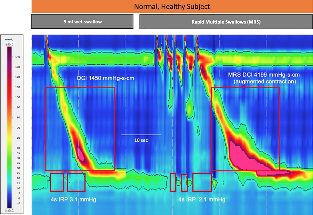 FIGURE 3