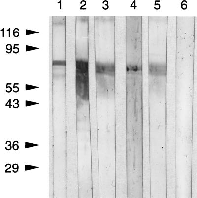 FIG. 11