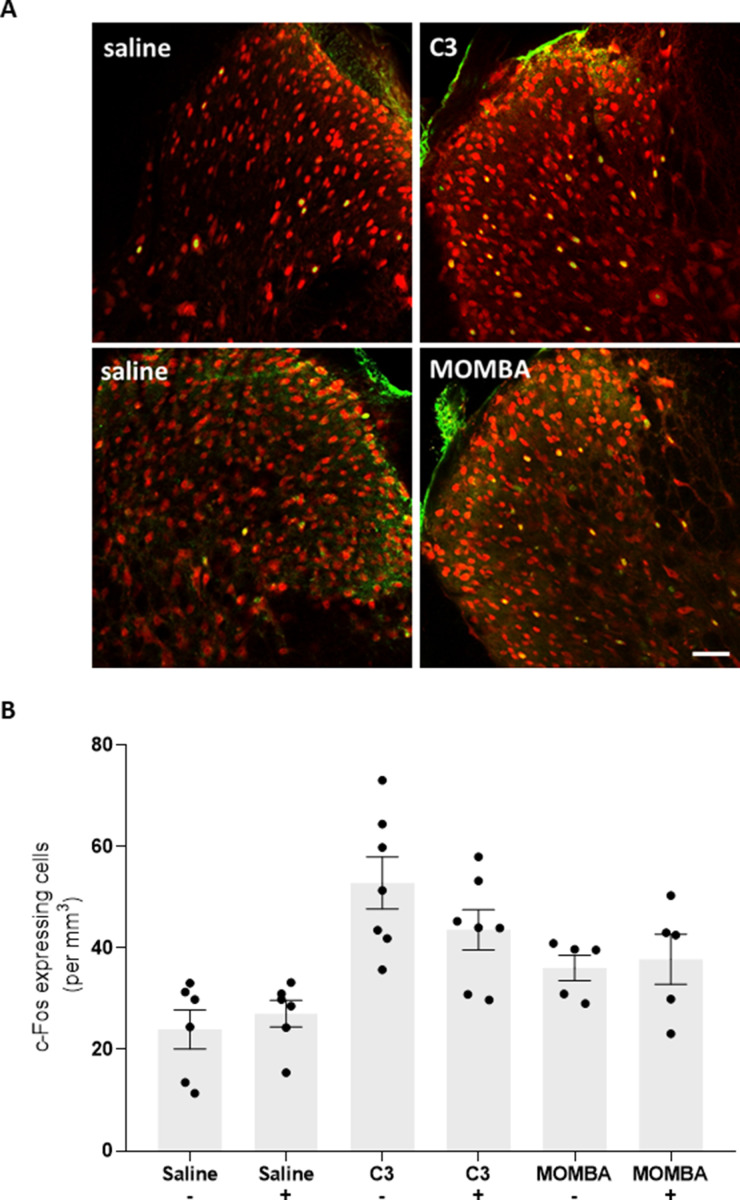 Figure 5—figure supplement 1.