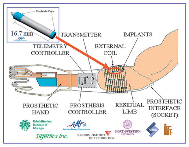 FIG. 1