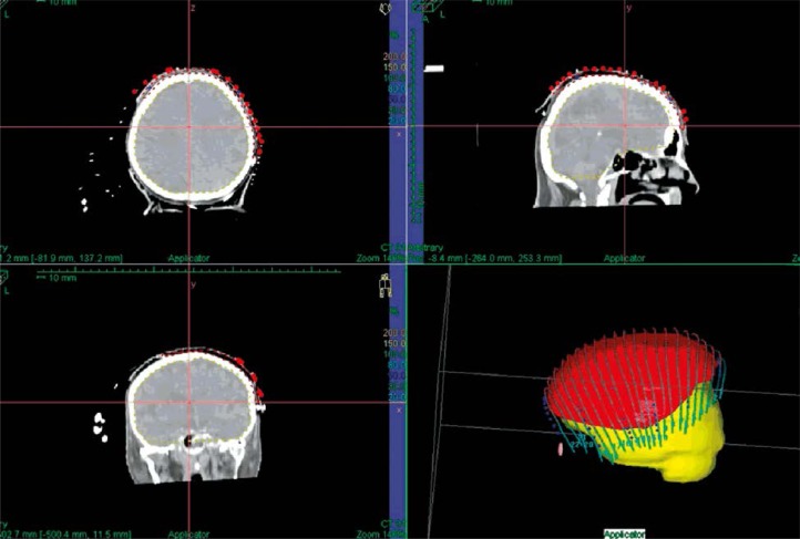 Fig. 4