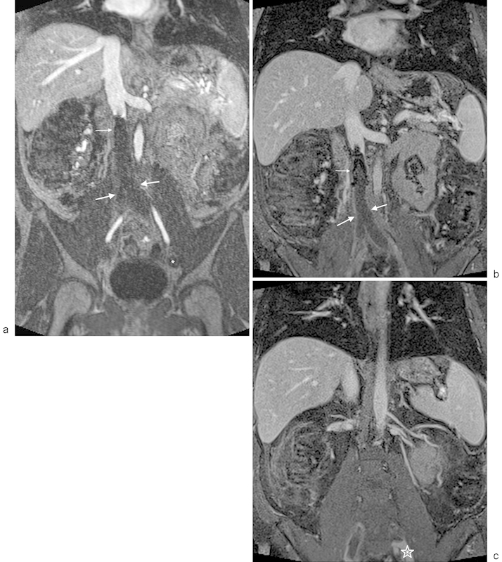 Fig. 13