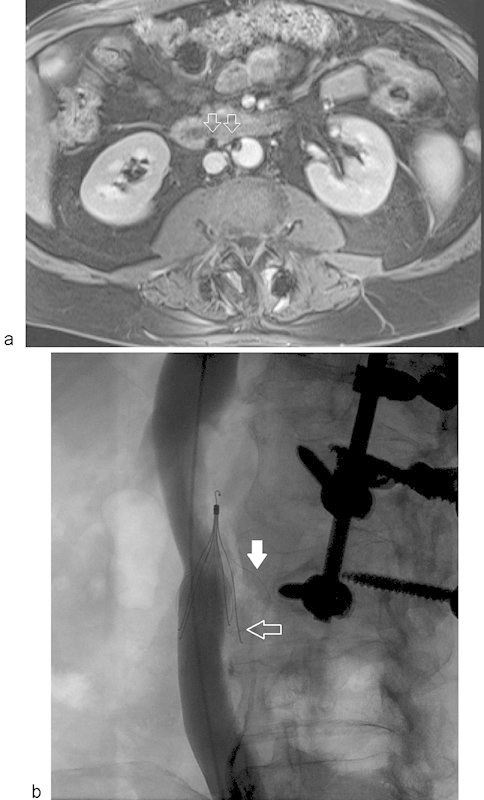 Fig. 11