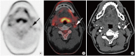 Figure 14.