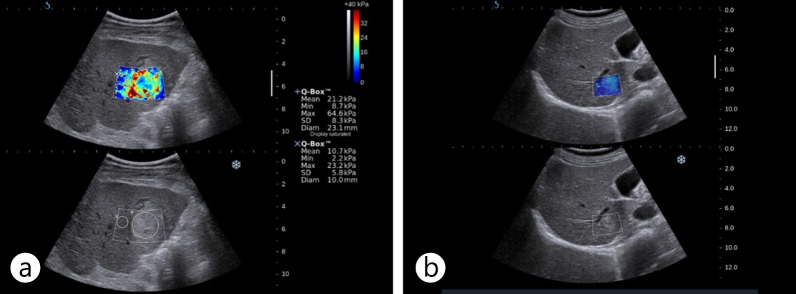 Fig. 12