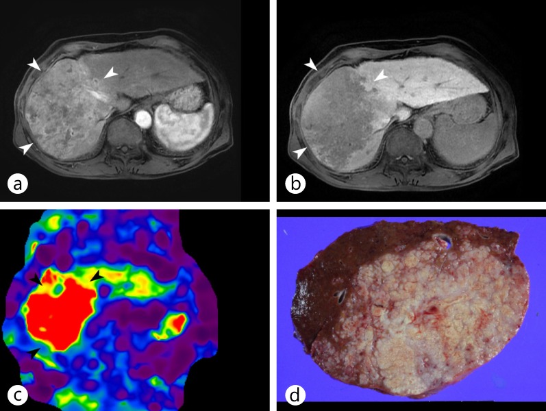 Fig. 13