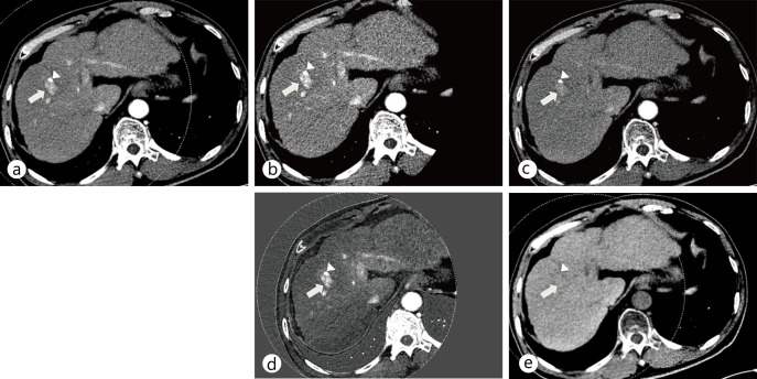 Fig. 3