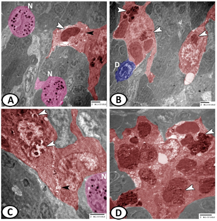 Figure 11