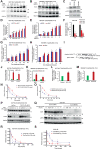 Figure 6. c-MYC mRNA levels and protein stability upon alterations in ECD levels. Western blot of ECD and c-MYC protein, HSC-70 used as a loading control (A–C) and mRNA by qRT-PCR (D–F) in indicated cell lines. G and H, Time-dependent mRNA expression of c-MYC upon induction of ECD. mRNA quantitation data represents mean ± SEM with two-tailed unpaired t test. n = 3; *, P < 0.05; **, P < 0.01; ***, P < 0.001. Schematic display of the qPCR primer pairs (marked arrows) used to measure pre-mRNA and mature mRNA species (I). Bar graphs show overexpression of ECD resulted in upregulation of c-MYC mRNA (J and K). Pre-mRNA to mRNA ratio in ECD-overexpressing cells is shown in bar graphs as fold change in comparison with controls. 18S was used for normalization (L and M). The stability of c-MYC mRNA was analyzed in doxycycline-inducible ECD-overexpressing indicated cells in the presence or absence of doxycycline for 72 hours. The cells were treated with actinomycin D (5 μg/mL) for indicated time points and qRT-PCR was performed after RNA isolation. GAPDH was used for normalization. Half-life of c-MYC mRNA in MCF10A (N) and 76NTERT (O). Data represents mean± SE of three independent experiments. The stability of c-MYC protein was analyzed in doxycycline-inducible ECD-overexpressing MCF10A cells in the presence or absence of doxycycline for 72 hours. The cells were treated with cycloheximide (50 mmol/L) for indicated time points and lysates were collected. P, Western blot with indicated antibodies. P and R, Half-life of c-MYC protein in ECD overexpressing MCF10A cells. Q and S, c-MYC protein stability was analyzed after 48 hours of treatment of SUM-159 with control or ECD siRNA, followed by CHX treatment. Q, Western blot shows c-MYC protein in ECD KD cells. S, Exponential decay plot shows half-life of c-MYC upon ECD KD. Densitometry of c-MYC after normalizing to loading control GAPDH in comparison with no CHX treatment are indicated on top in (P) and (Q). NS, not significant; DOX, doxycycline; h, hours.