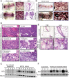 Figure 1. ECD overexpression promotes mammary gland hyperplasia, heterogeneous tumors, and preneoplastic lesions. A, Representative whole-mount staining images of littermate control and mouse mammary gland in ECDTg mouse at 5 to 6 months of age. Scale bar, 400 μm; inset 1,000 μm. B, H&E staining of ECDTg tumors. Scale bar, 100 μm. C, Western blot for ECD expression (tumor numbers in Supplementary Table S1). D, Age-matched control and ECDTg mammary gland at 15 to 25 months, inset 1,000 μm. E, H&E staining of ECDTg mammary gland. Scale bar, 400 μm; and inset 100 μm. F, Western blot for ECD protein. HSC-70, used as a loading control. MG, mammary gland.