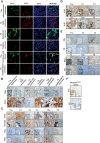 Figure 2. Characterization of ECDTg tumors by IHC. A to F, ECDTg tumor subtypes were immunostained with indicated antibodies. Scale bar, 50 μm (magnification 400X); inset scale bar, 10 μm (magnification 1,000X).