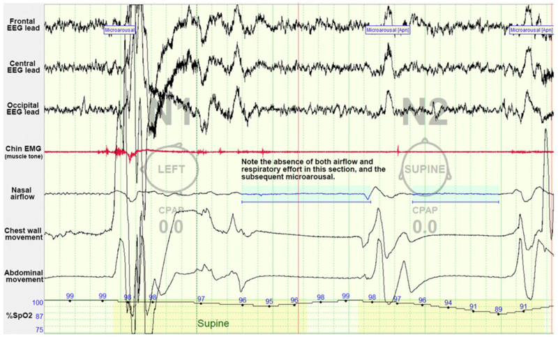 Figure 3: