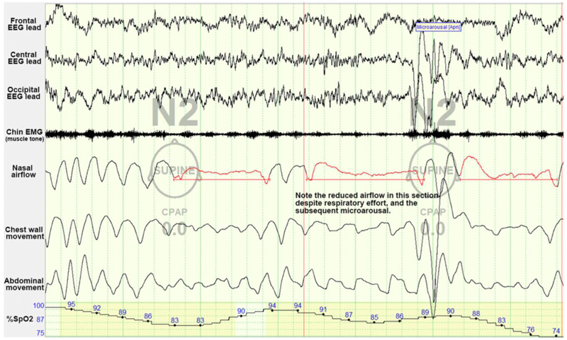 Figure 2: