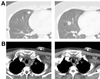 Fig 5.