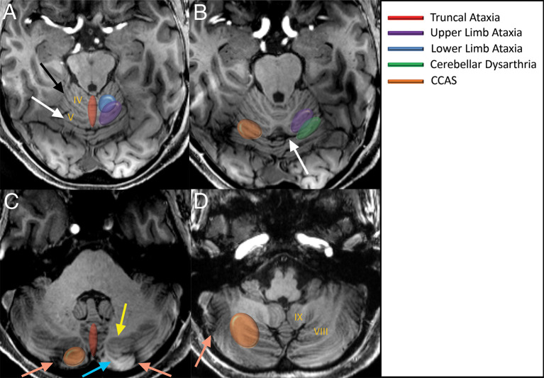 Figure 11.