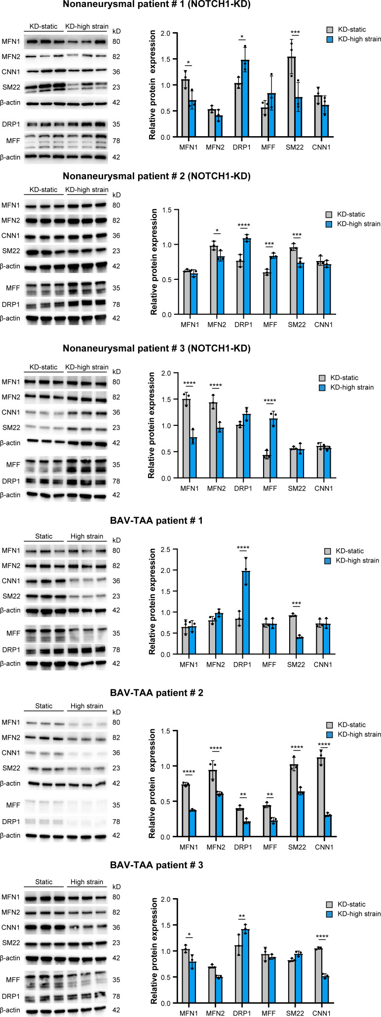 Figure 6—figure supplement 1.