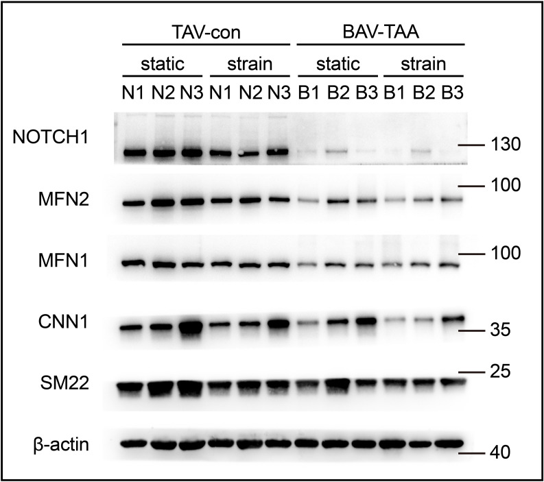 Figure 6—figure supplement 2.