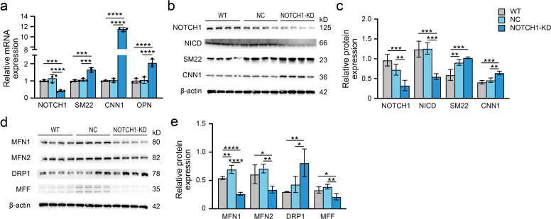 Figure 4—figure supplement 1.