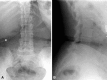 Fig. 1A–B