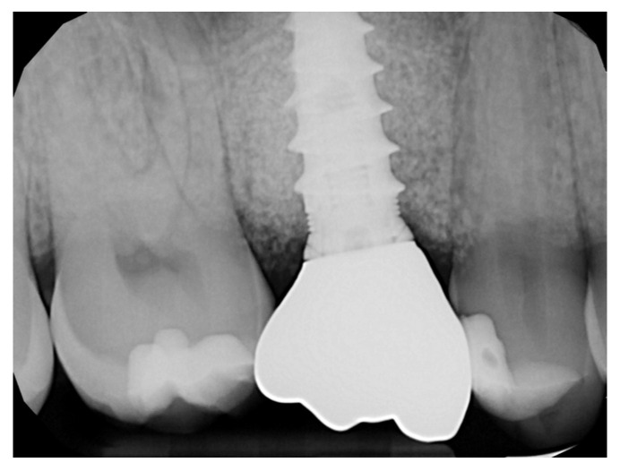 Figure 16