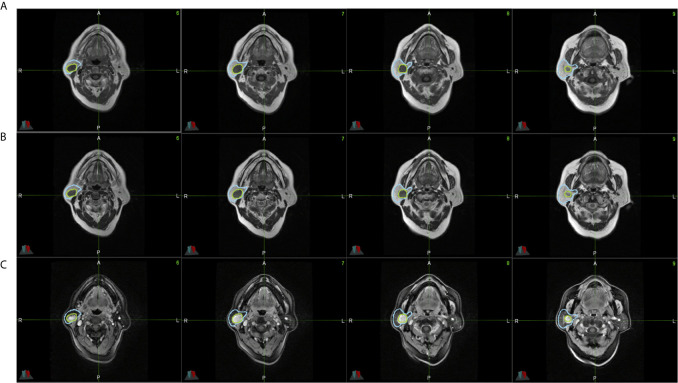 Figure 2