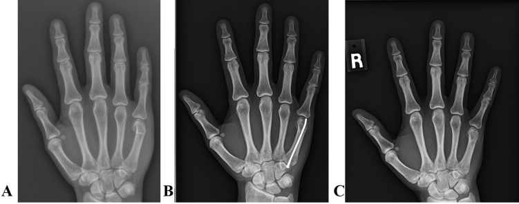 Figure 5