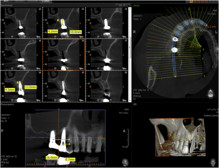 Figure 11