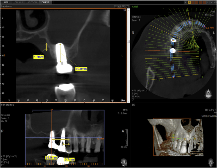 Figure 12