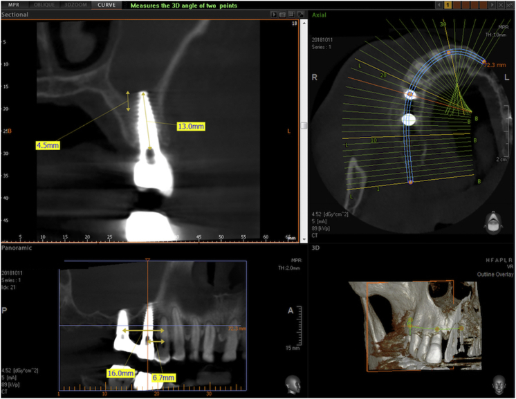 Figure 13