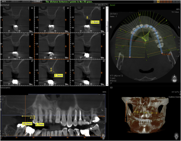 Figure 10