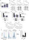 Figure 1. The Polθ inhibitor ART558 radiosensitizes tumor cells. A and B, Clonogenic survival of HCT116, H460, and T24 cells treated with ART558 and/or IR. A, Plating efficiency for unirradiated cells. B, Surviving fractions as a function of the irradiation dose. Representative wells for 0 Gy and 6 Gy ± 1 μmol/L ART558 are shown for each cell line. C, Clonogenic survival of U2OS WT and Polθ KO cells treated with 3 μmol/L ART558 and 6 Gy IR. Bar graphs show the surviving fraction at 6 Gy. The Western blot insets confirm the lack of Polθ expression in the U2OS Polθ KO cells. D, Clonogenic survival of HCT116 and H460 cells transfected with either a control, nontargeting siRNA (siNT) or an siRNA targeted against POLQ (siPOLQ) and treated with 3 μmol/L ART558 and 6 Gy IR. Bar graphs show the surviving fraction at 6 Gy. Western blots show Polθ expression at the time of irradiation. E, Clonogenic survival of H460 and HCT116 treated with 3 μmol/L ART558 and 2×5 Gy (2 Gy once per day for 1 to 5 days). F and G, Clonogenic survival following irradiation and treatment with 3 μmol/L ART558 of synchronized HeLa cells. F, Representative histograms showing the cell-cycle distribution at the time of IR (synchronized in G1 by DT block or after 6 hours release from DT block, compared with asynchronous cultures). G, Degree of radiosensitization estimated by the ratio between the surviving fraction of DMSO- and ART558-treated cells after IR (SF DMSO/SF ART558). Data correspond to average ± SD from three independent experiments (*, P < 0.05; **, P < 0.01; ***, P < 0.001; ****, P < 0.0001).