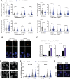 Figure 2. ART558 treatment leads to increased residual IR-induced DNA damage foci. A, γH2AX and 53BP1 foci in HCT116 and H460 cells treated with 3 μmol/L ART558 and 4 Gy IR, assessed at the indicated times points after IR. B, Representative images from irradiated cells from the experiment described in A, at 16 hours after IR. C, Micronuclei in HCT116 and H460 cells treated with 3 μmol/L ART558 and 4 Gy IR, assessed 48 hours after IR. Data points indicate the mean ± SD from triplicate wells and graphs are representative from three separate experiments. D, Representative images from irradiated cells from the experiment described in C. Micronuclei are indicated with arrow heads. E, RAD51 foci in HCT116 and H460 cells treated with 3 μmol/L ART558 and 4 Gy IR, assessed 6 hours after IR. F, Representative images from irradiated cells from the experiment described in E. Lines and error bars in A and E correspond to average ± SD representative from three independent experiments, and statistical significance was calculated using nonparametric one-way ANOVA (Kruskal–Wallis) with Dunn correction for multiple comparisons (*, P < 0.05; **, P < 0.01; ***, P < 0.001; ****, P < 0.0001).