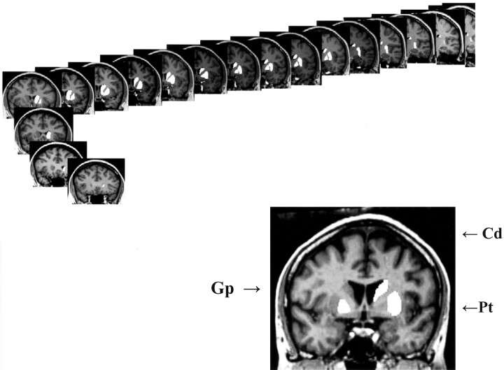 Fig 1.